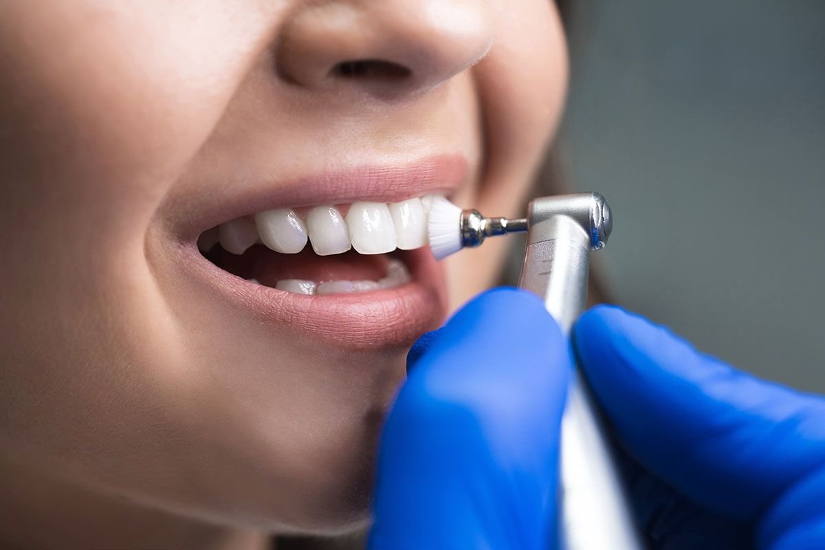 General Dentistry and Routine Oral Care in Guruvayur